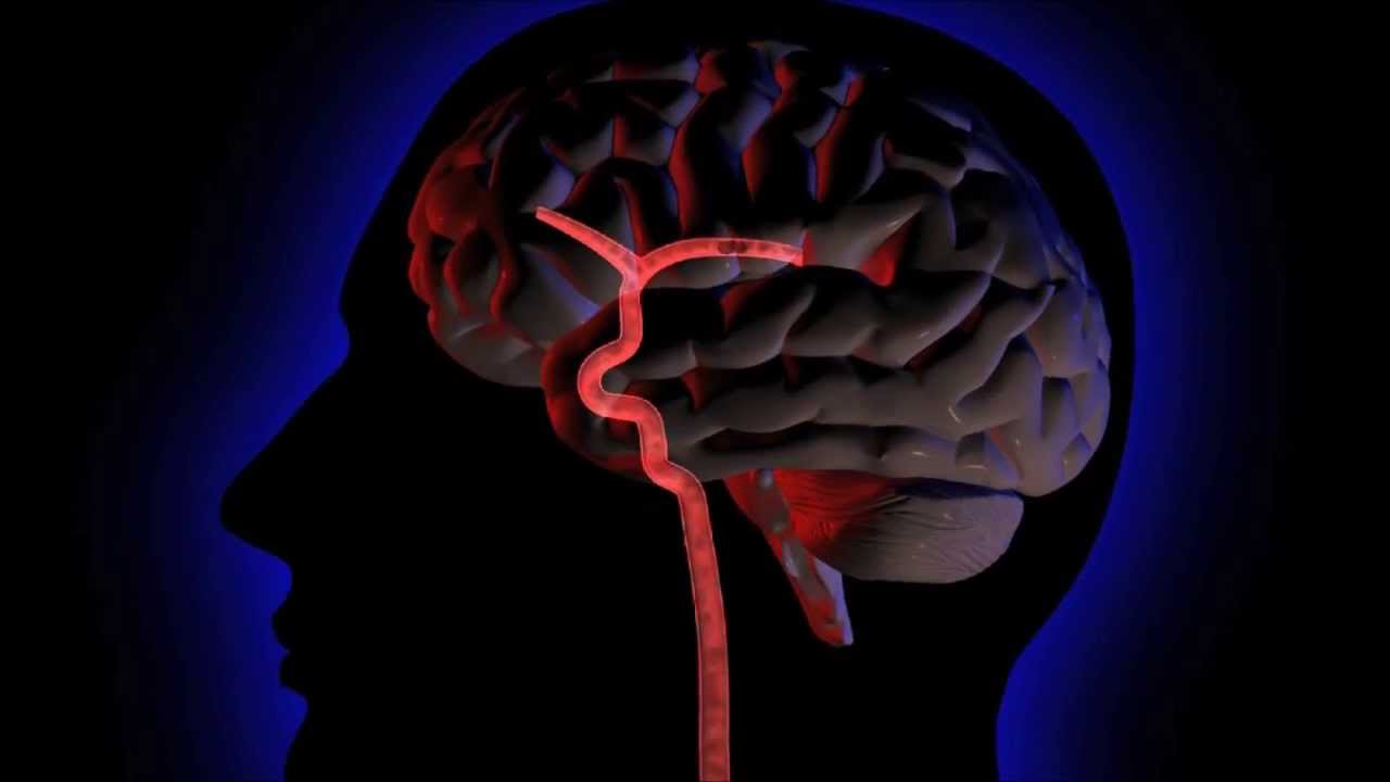 Шум в голове в мозге